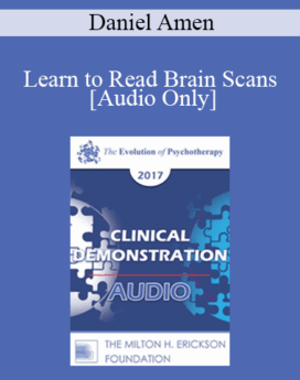 [Audio] EP17 Clinical Demonstration 10 - Learn to Read Brain Scans: 50 cases in 60 Minutes - Daniel Amen, MD