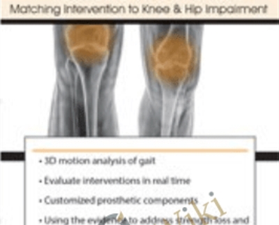 Total Joint Rehabilitation: Matching Intervention to Knee & Hip Impairment - Chad M. Thompson